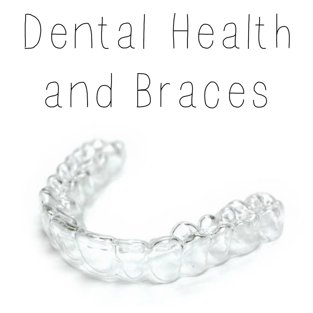 Dental Health and Braces